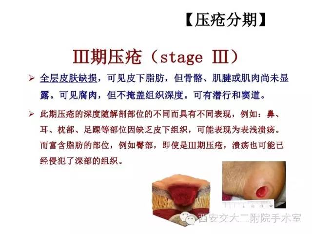 2016压疮最新指南，护理宝典